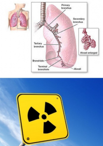 radon gas affecting lungs