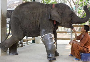 Mosha fitted with new prosthetic limb
