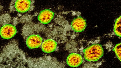 Can you be infected with coronavirus twice?