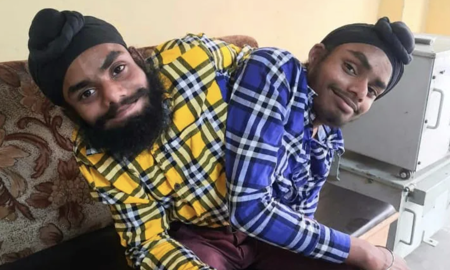 Sohna and Mohna Singh conjoined twins